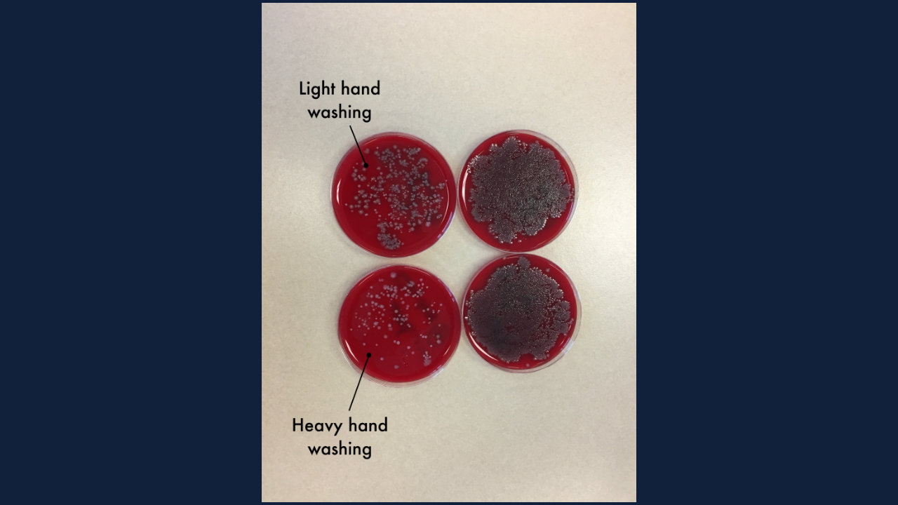 Hand sanitizer vs. soap and water Which works better?